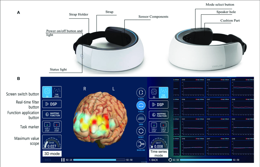 Brain Imaging