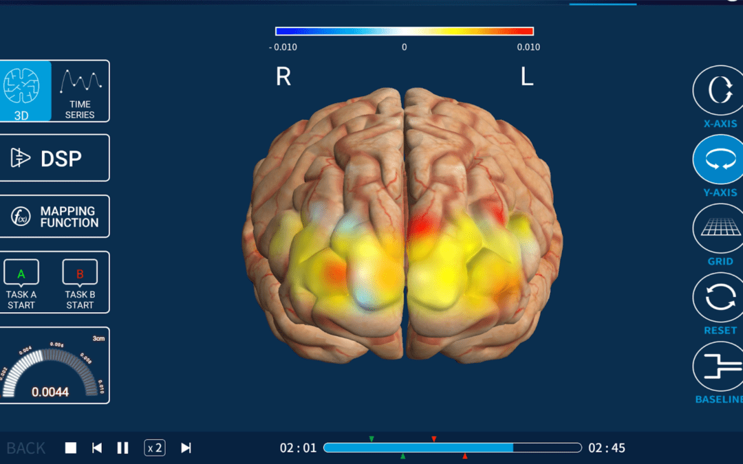 fNIRS Brain Imaging